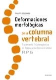 DEFORMACIONES MORFOLÓGICAS DE LA COLUMNA VERTEBRAL | 9788491130635 | SOUCHARD, PHILIPPE